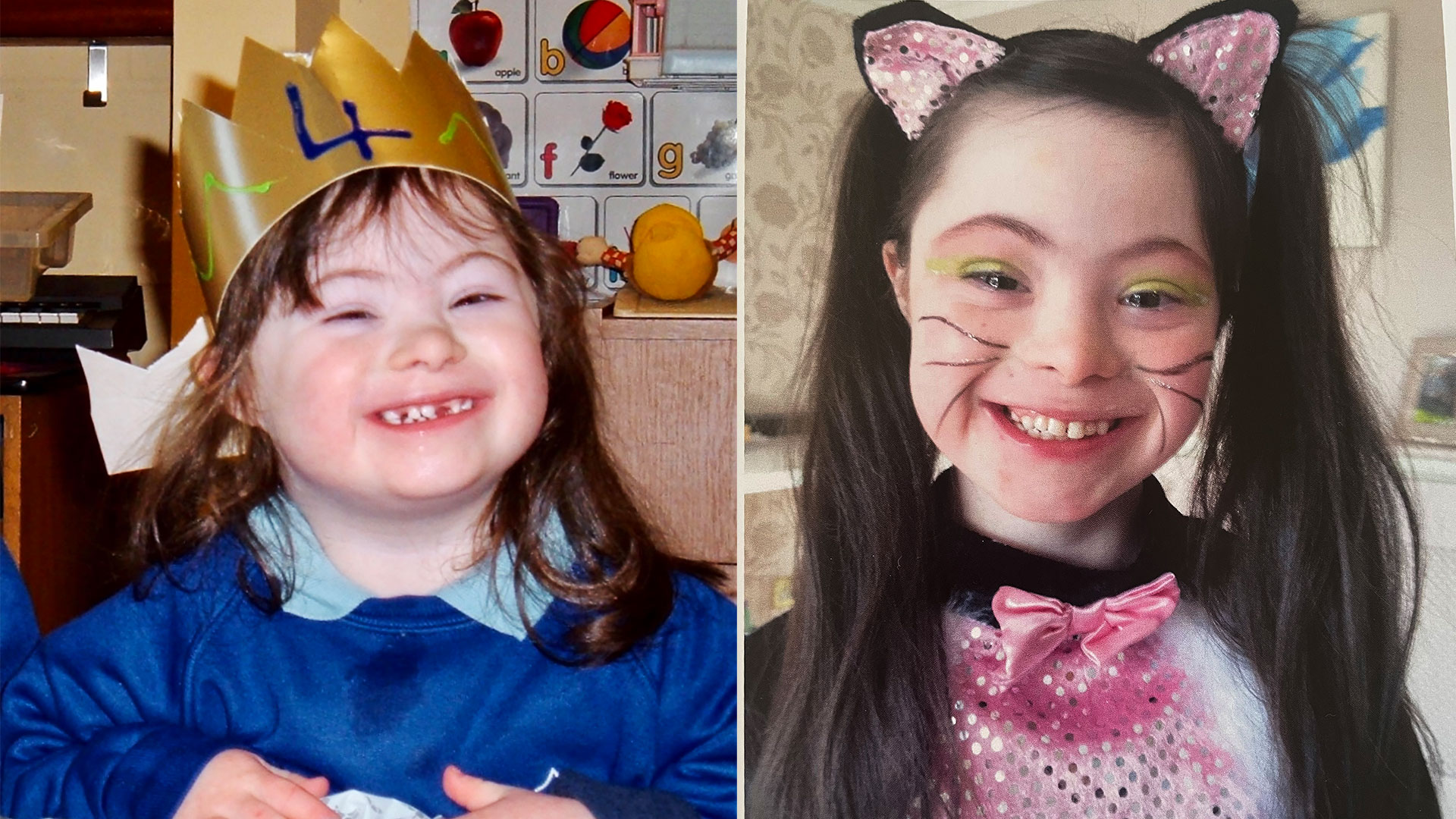 Two photos of Ellie Goldstein as a child: one in a crown on her birthday; and one in a cat costume.